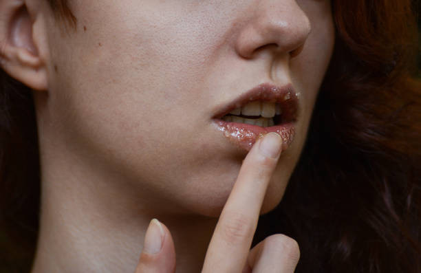 Cari Masker Alami untuk Scrub Bibir? Madu dan Gula Bisa Jadi Solusi yang Wajib Dicobain!