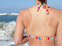 Langkah-langkah Perawatan Harian untuk Mencegah Hiperpigmentasi, Tampilkan Kulit Sehat dan Bersinar