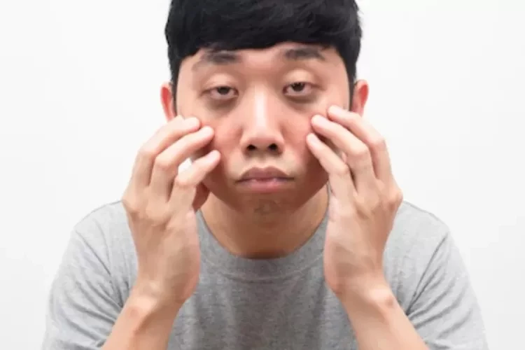 8 Faktor Penyebab Mata Bengkak, Mulai dari Kurang Tidur Hingga Adanya Gangguan pada Sistem Limfatik