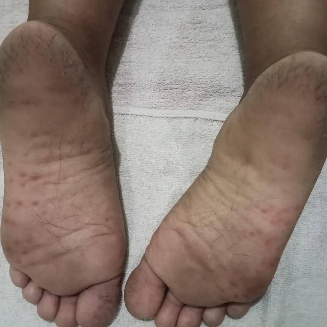 10 Cara Mudah Mengatasi Kaki Pecah-Pecah di Rumah, Nomor 1 Gampang Banget!