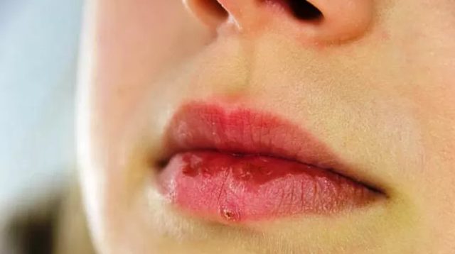5 Rekomendasi Produk Lip Mask Yang Ampuh Untuk Mengatasi Masalah Bibir Kering