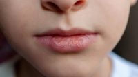 5 Rekomendasi Produk Lip Serum Yang Ampuh Untuk Mengatasi Bibir Kering