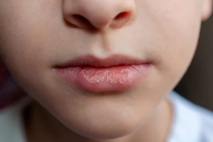 5 Rekomendasi Produk Lip Serum Yang Ampuh Untuk Mengatasi Bibir Kering