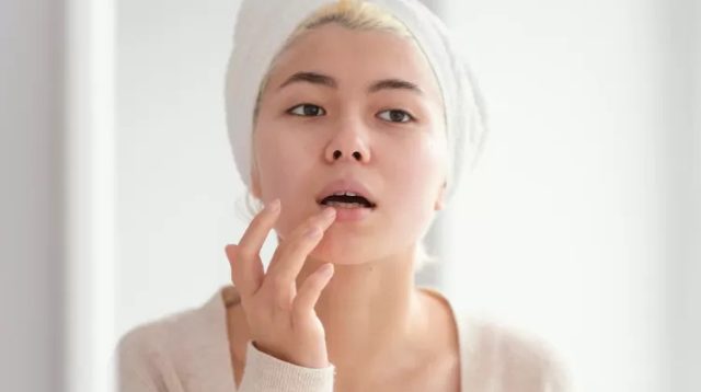 8 Tips Mencerahkan Bibir Gelap Akibat Kebiasaan Merokok Yang Ampuh dan Aman