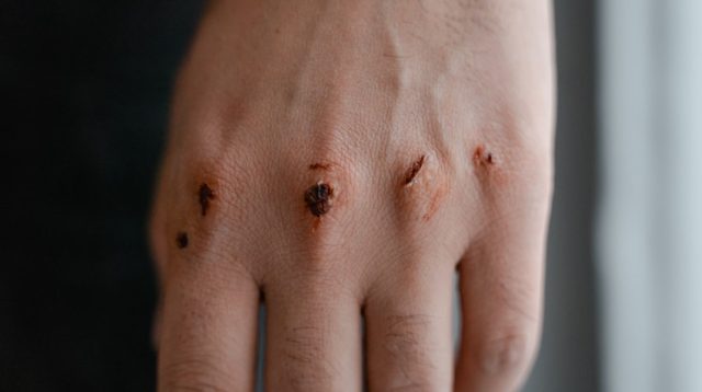 Tips dan Trik Merawat Kulit dengan Lidah Buaya, Jangan Abaikan Peringatan di Akhir Tulisan!