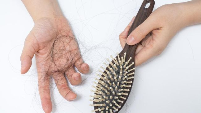 Mitos atau Fakta? Ini Penyebab Umum Rambut Rontok yang Perlu Anda Ketahui Kebenarannya