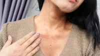 Micin dan Reaksi Alergi yang Ditimbulkannya, Berikut Fakta, Mitos, dan Tinjauan Ilmiah Menurut WHO