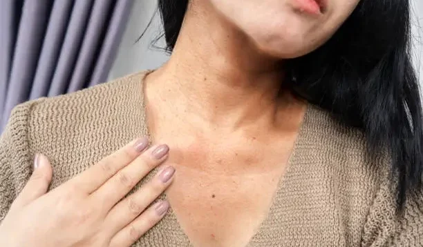 Micin dan Reaksi Alergi yang Ditimbulkannya, Berikut Fakta, Mitos, dan Tinjauan Ilmiah Menurut WHO