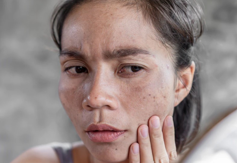 Buat Semua Mata Terpana! Cerahkan Kulit Kusam dengan Masker Alami Alpukat dan Stroberi, Begini Caranya