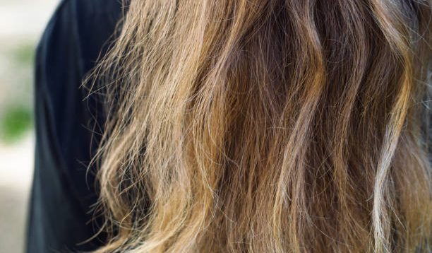 11 Tips Mengatasi Rambut Kering dan Ketombe, Solusi untuk Rambut Sehat dan Bebas Ketombe