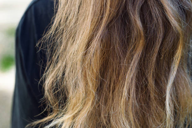 11 Tips Mengatasi Rambut Kering dan Ketombe, Solusi untuk Rambut Sehat dan Bebas Ketombe