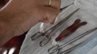 6 Manfaat Sunat, Bawa Berbagai Keuntungan bagi Kesehatan dan Hygiene