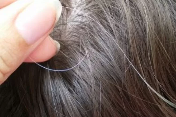 Benarkah Stres dapat Mempengaruhi Kesehatan Rambut Anda? Begini Ulasannya