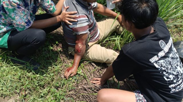 Berhenti Terlalu Mepet, Pemotor di Blitar Tertabrak Kereta Api, Nyawanya Masih Selamat