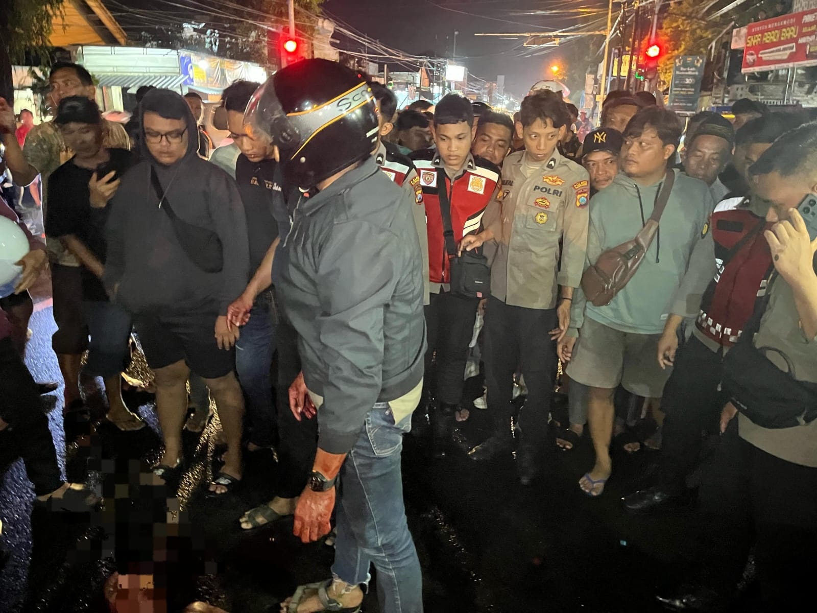 Diduga ODGJ, Jalani Perawatan Intensif dan Dioperasi setelah Kondisi Sabil