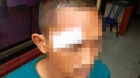 Dua Pemuda Mojo Jadi Korban Pengeroyokan di Kediri, Polisi Selidiki Rekaman CCTV