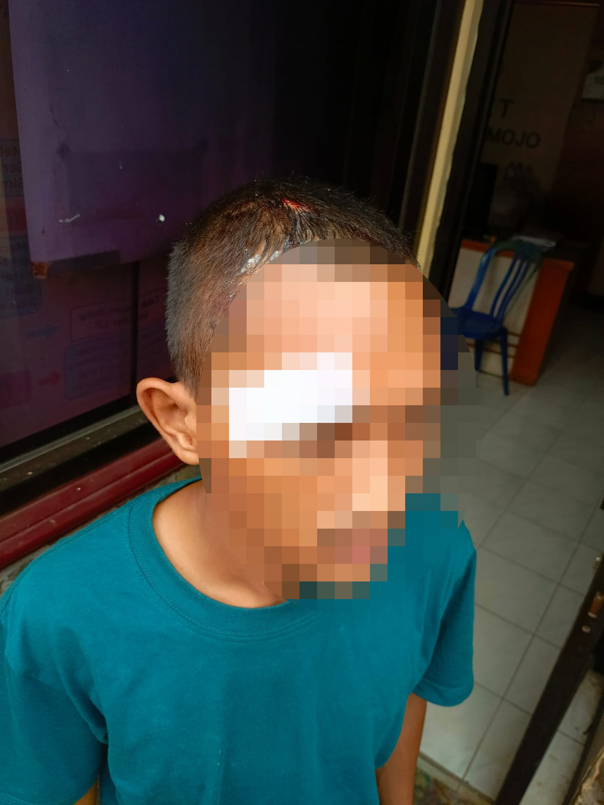 Dua Pemuda Mojo Jadi Korban Pengeroyokan di Kediri, Polisi Selidiki Rekaman CCTV