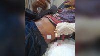 f-penusukan Korban menjalani perawatan.